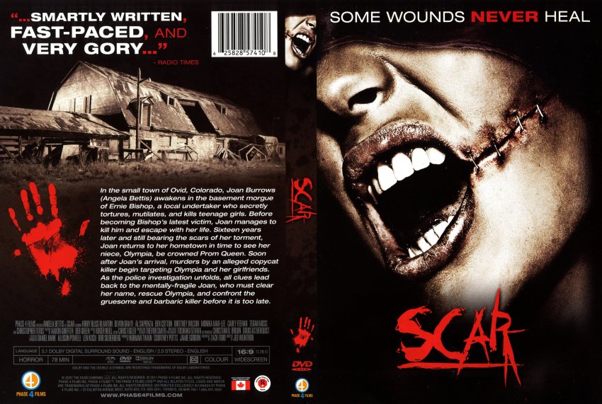 Scar