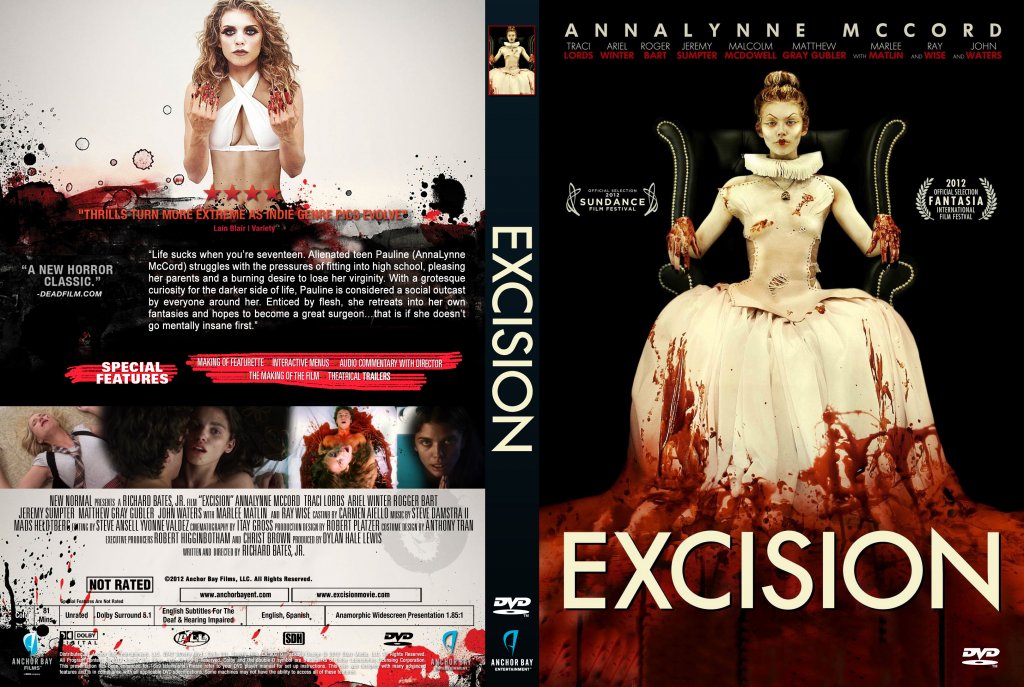 Excision