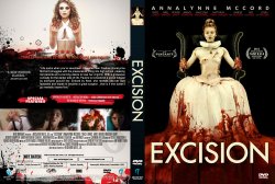 Excision