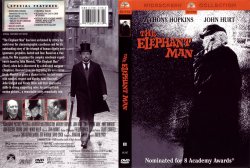 the elephant man