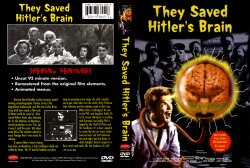 They Saved Hitler's Brain